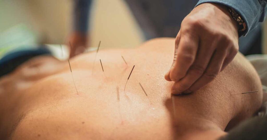 The Science Behind Acupuncture